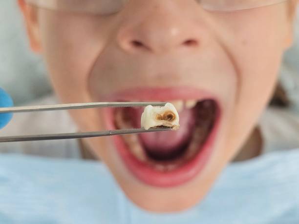 Best Emergency Broken Tooth Repair in Alamo, GA